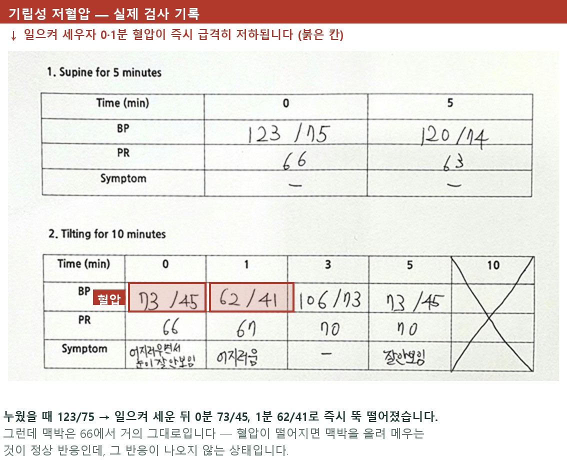 기립성 저혈압의 자율신경 기능검사 기록 — 누웠을 때 123/75이던 혈압이 일으켜 세운 뒤 73/45로 떨어졌고 맥박은 66에서 거의 변하지 않았습니다