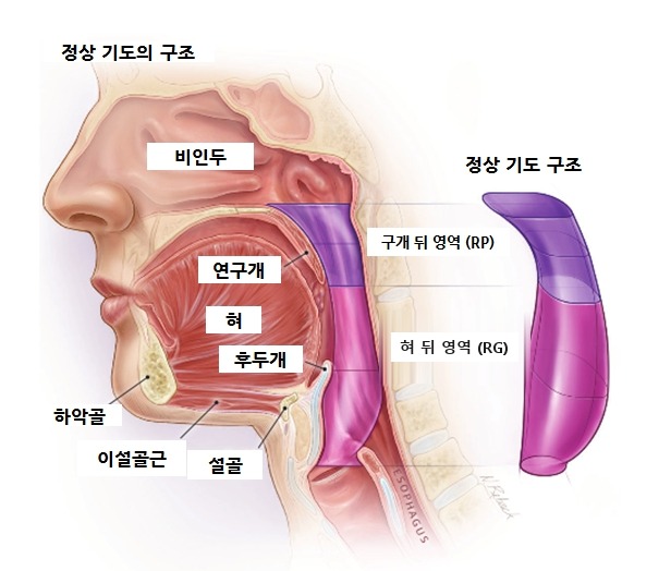 정상 기도의 해부학적 구조 — 비인두, 구개 뒤 영역, 혀 뒤 영역을 지나 기관으로 이어집니다