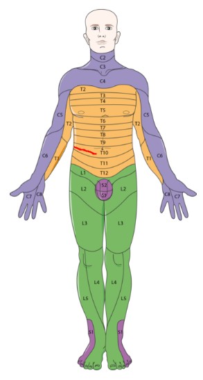 더마톰 지도 — 몸을 가로로 나눈 피부 구역이 각각 하나의 척수 신경에 대응합니다