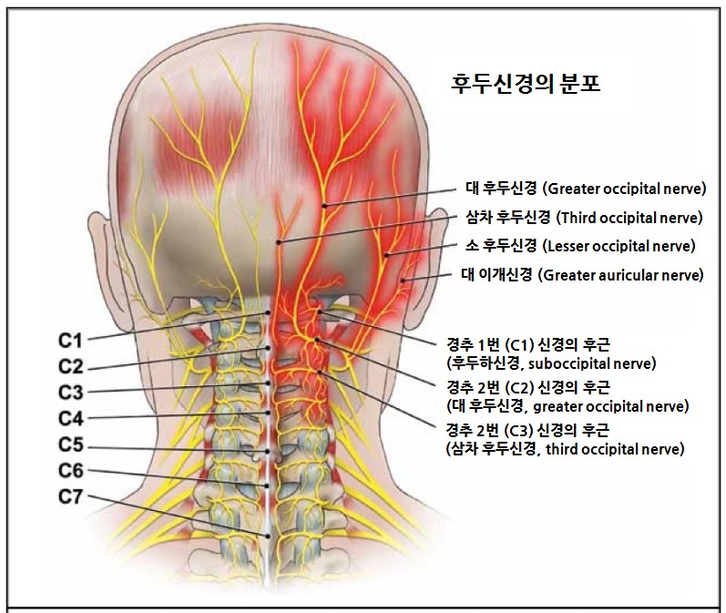 뒤에서 본 머리와 목의 후두신경 분포 — 경추 신경근에서 나온 대후두신경·소후두신경·제3후두신경이 뒤통수와 정수리, 귀 뒤를 나눠 맡습니다